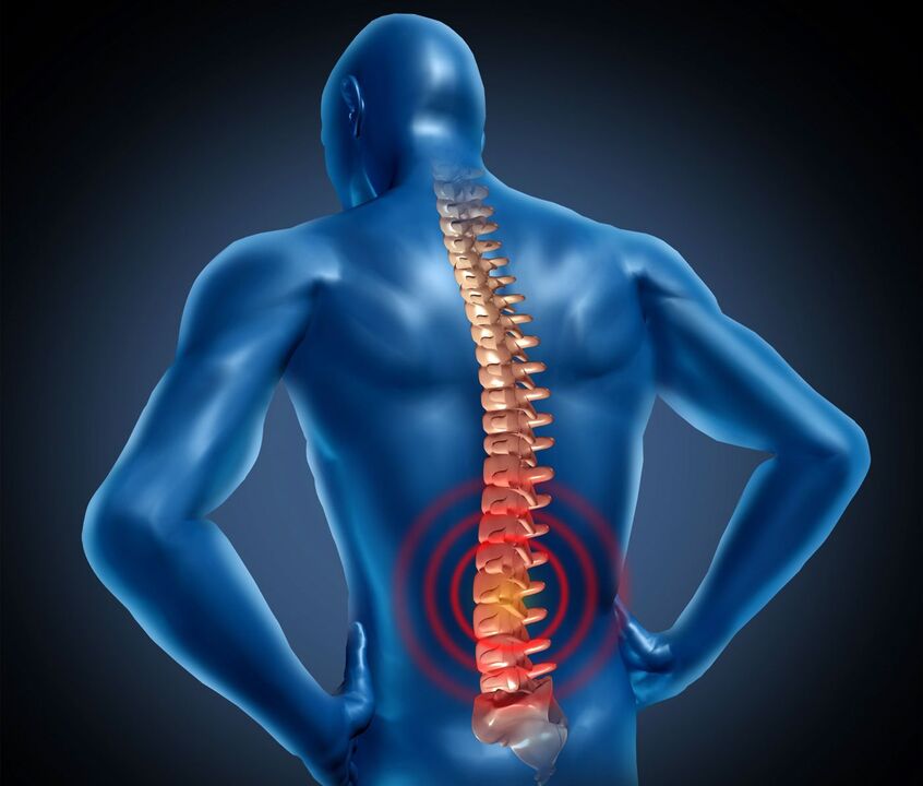 Osteocondrose lombar
