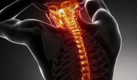 Osteocondrose de toda a coluna