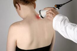 Tratamento da osteocondrose cervical com terapia a laser