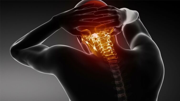 dor na parte de trás da cabeça com osteocondrose cervical