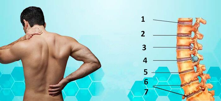 estágios de desenvolvimento da osteocondrose